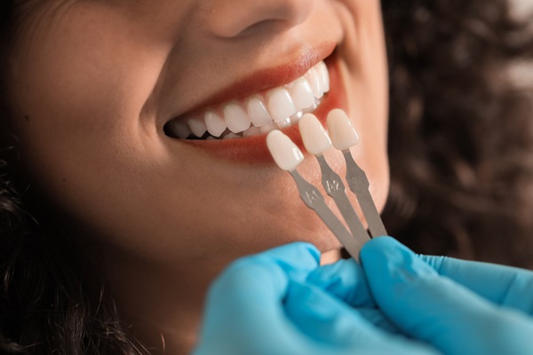 The Process Of Getting Dental Veneers: What To Expect